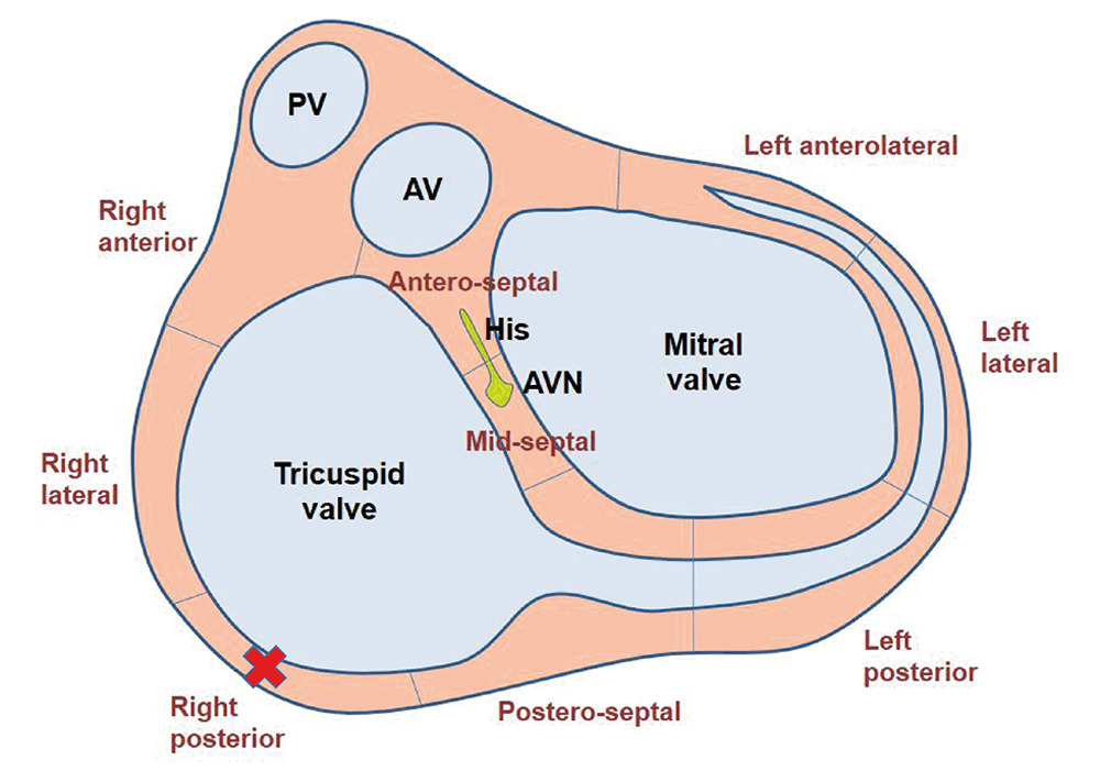 Approaches to treating a dog with supraventricular tachyarrhythmia