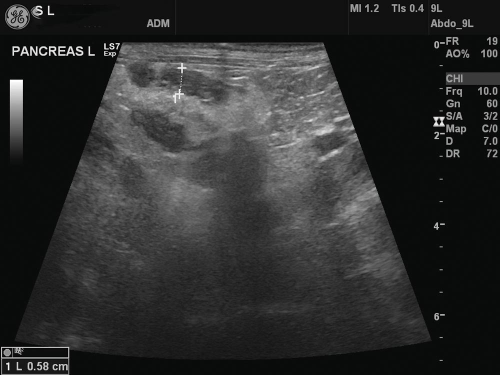 Managing acute gastrointestinal signs in cats and dogs: part 1
