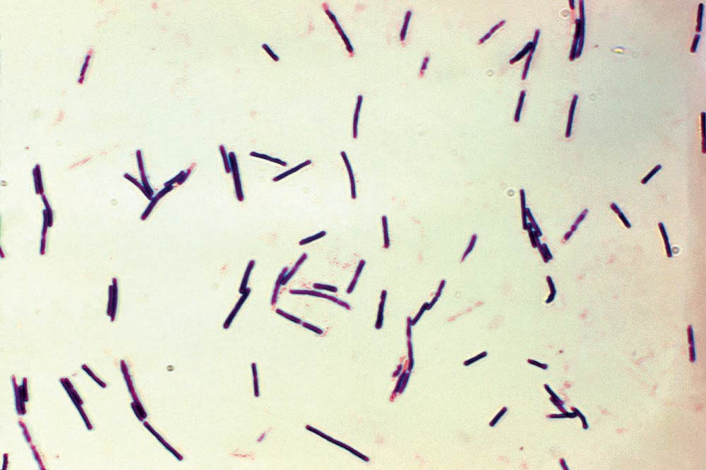 Diversification of clostridial conditions in cattle and sheep