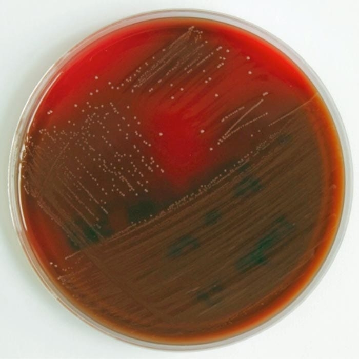 <em>Streptococcus uberis</em> – dealing with frustrating clinical mastitis