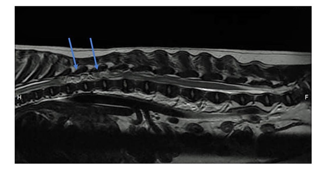 Spinal empyema in a springer spaniel: a clinical conundrum