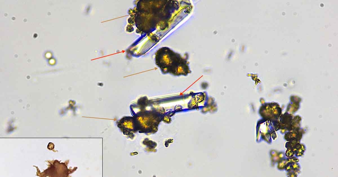 An eye-opening set of blood and urine findings in a dog