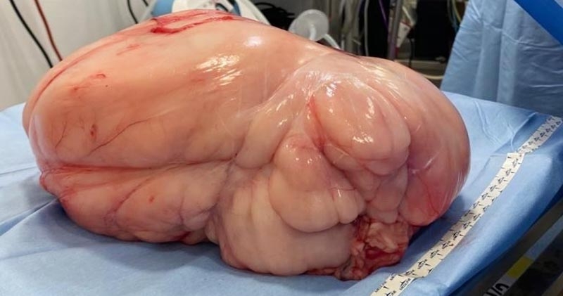 Labrador has 5kg growth removed
