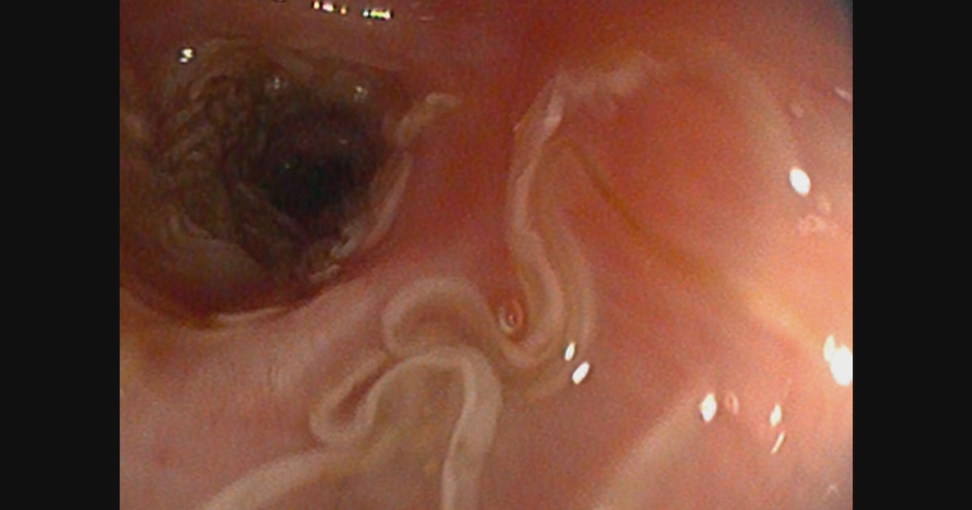 Dog survives despite lungs being full of worms 