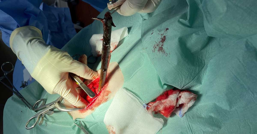 Staffie survives after foot-long stick removed