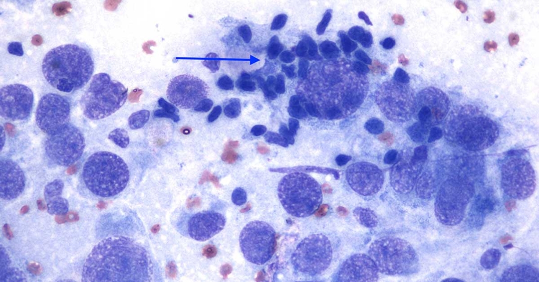 Cytology findings from a skin mass in a feline patient