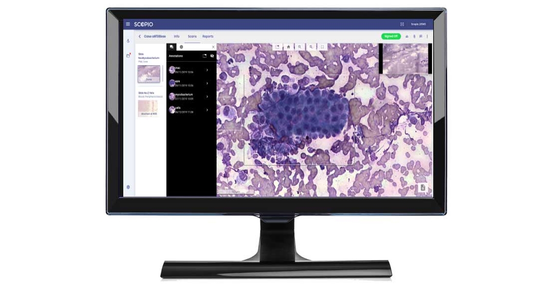 Digital pathology service rolls out across northern Europe