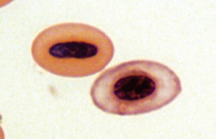 ASSESSMENT OF AVIAN ANAEMIA