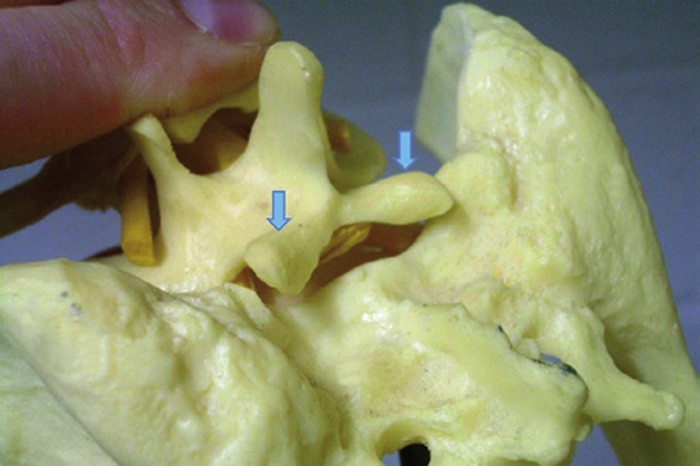 CANINE LUMBOSACRAL DISEASE