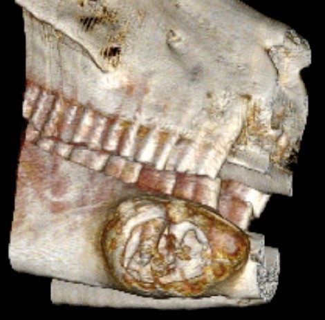 Use of CT in investigating dental disease in horses