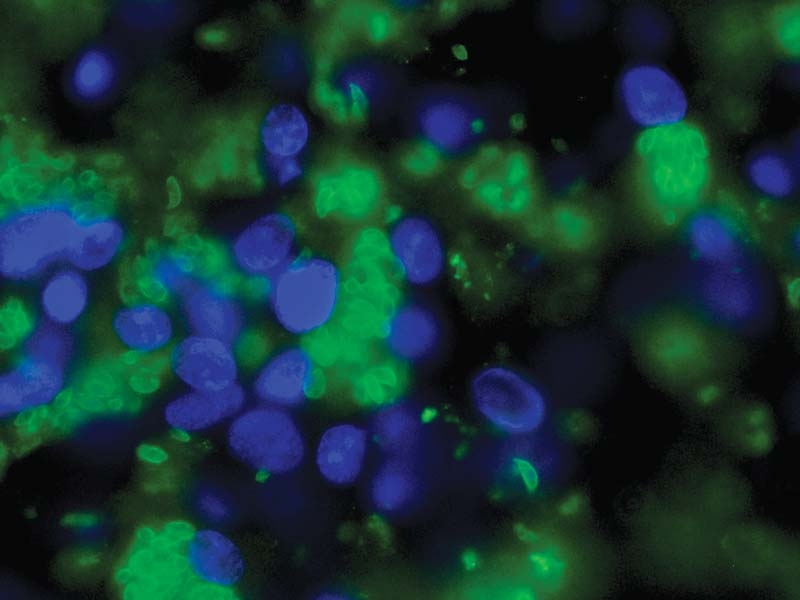 Neosporosis: quest for better diagnostics and interventions