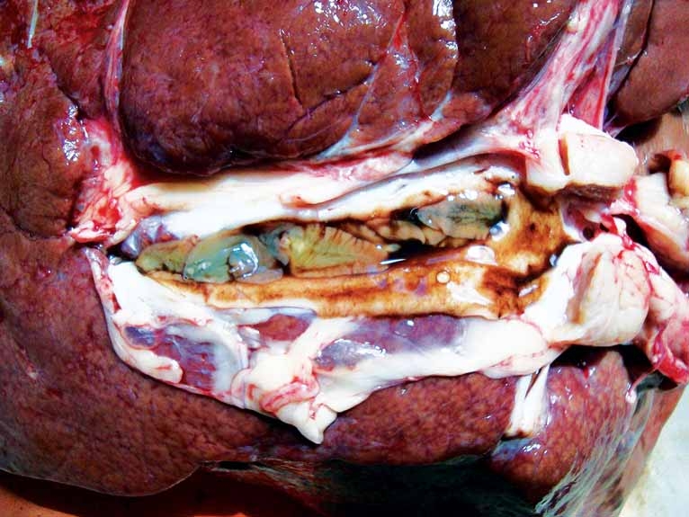 Diagnostic and management protocols for liver fluke