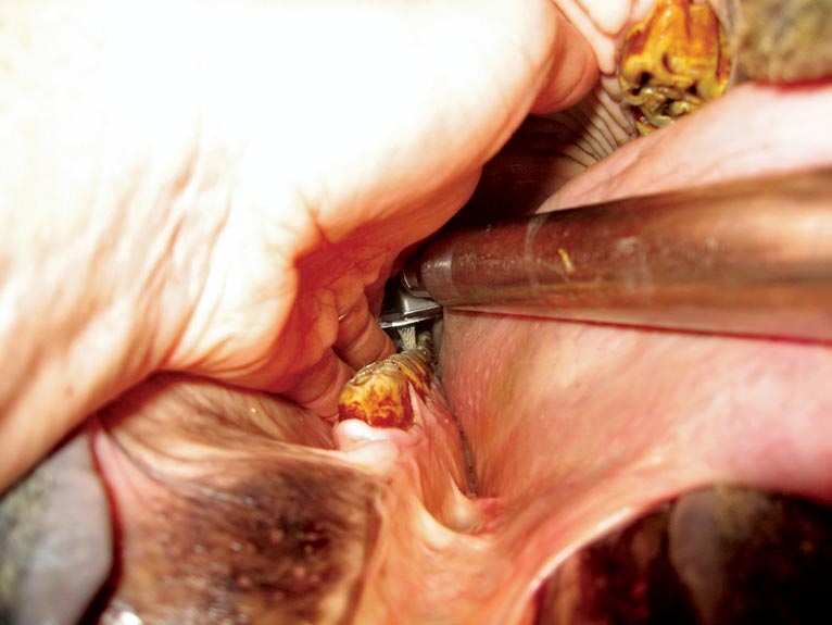 Evolutions in equine dentistry