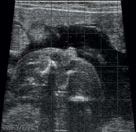 Ultrasound versus milk hormone test