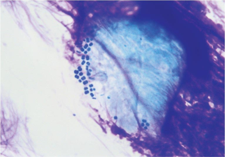 Time to act on antimicrobial resistance in canine pyoderma