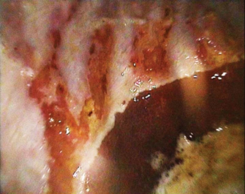 EGUS: clinical signs, diagnosis, treatment and prevention
