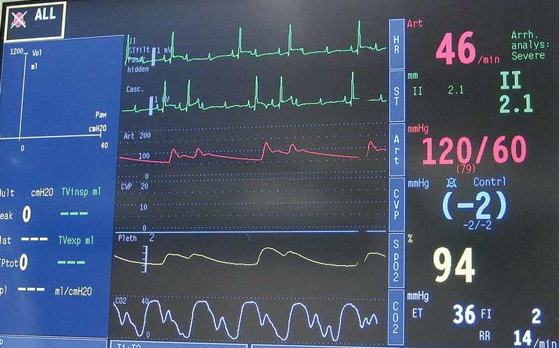 Knowing when to use atropine during surgery