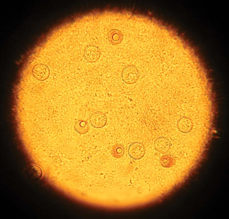 Toxoplasmosis: zoonotic risk and management strategies