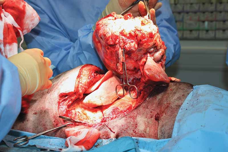 Evaluating tumour margins when preparing to treat cancer: part 2