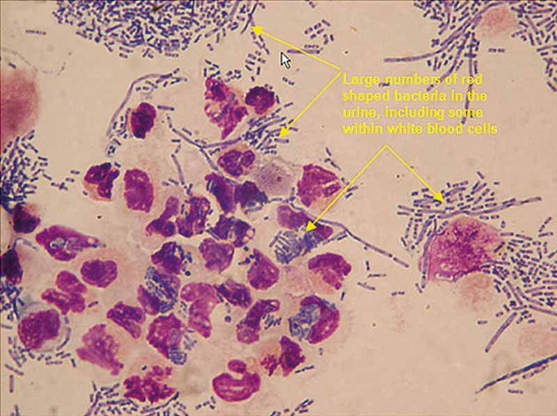 Managing feline chronic kidney disease: part 2 – complications