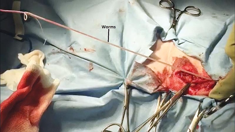Heartworm extraction in a dog