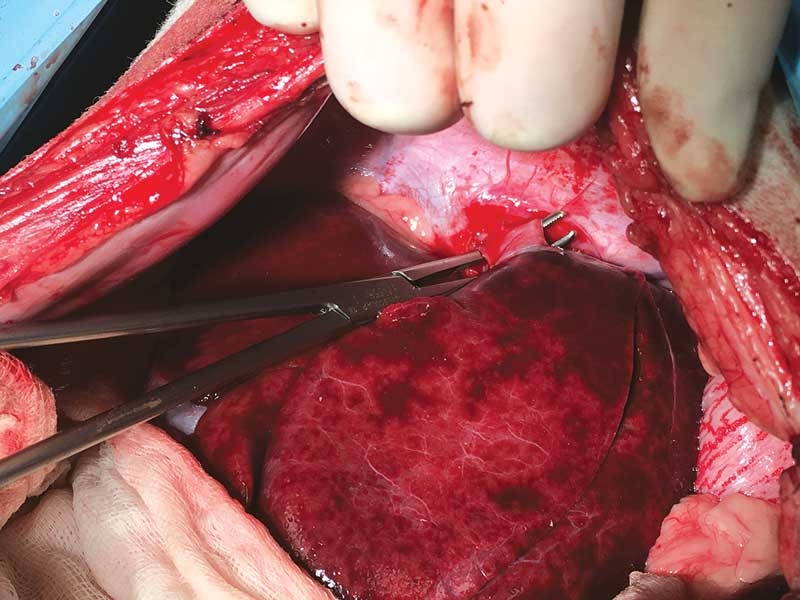 Advances in congenital portosystemic shunts