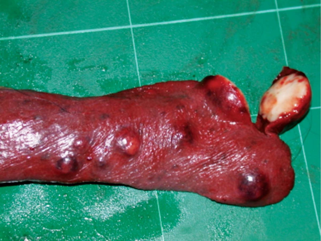 Flat-coated retriever dog tumour survey 25 years on