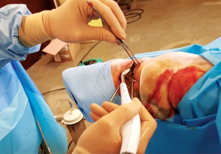 Equine wound management