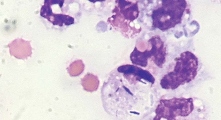 Approaches to diagnosing and treating hypoglycaemic patients