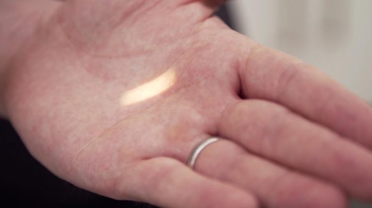 VIDEO THREE: ‘Back to Basics’ ophthalmology CPD series