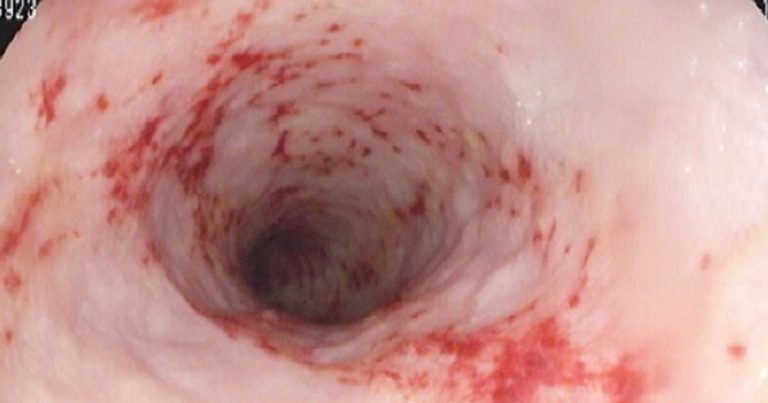 Canine chronic enteropathy