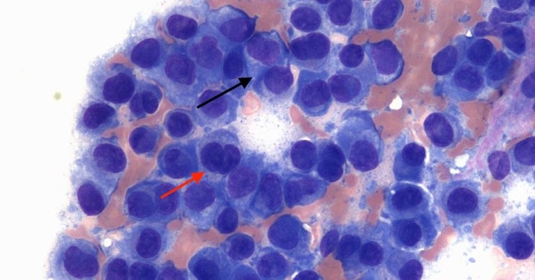 Digit mass in an elderly dog