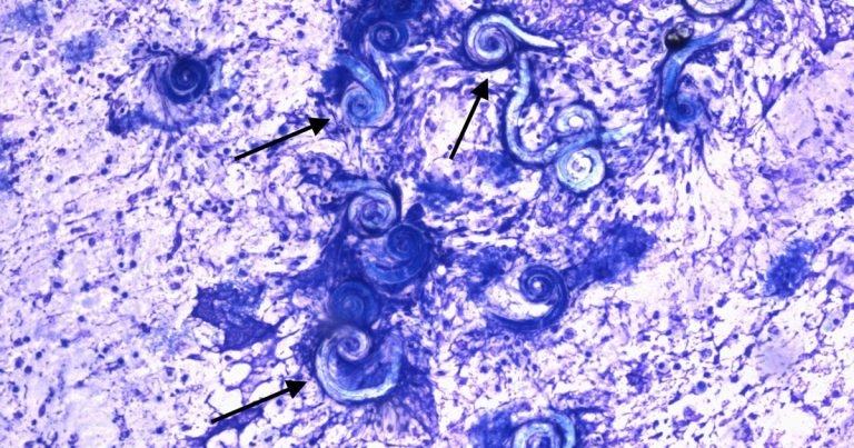 Bronchoalveolar lavage in a dog
