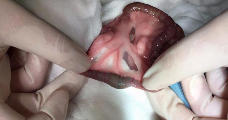Acute gastric dilation and jejunal obstruction in a domestic rabbit