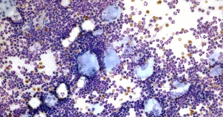 Case study: skin mass in a dog