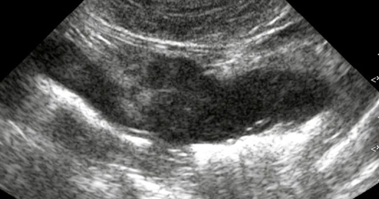 Intestinal lesion in a cat