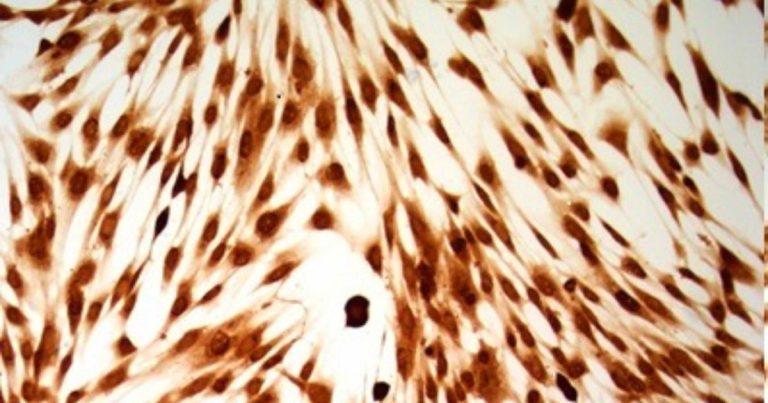Adipose mesenchymal stem cells in canine regenerative medicine