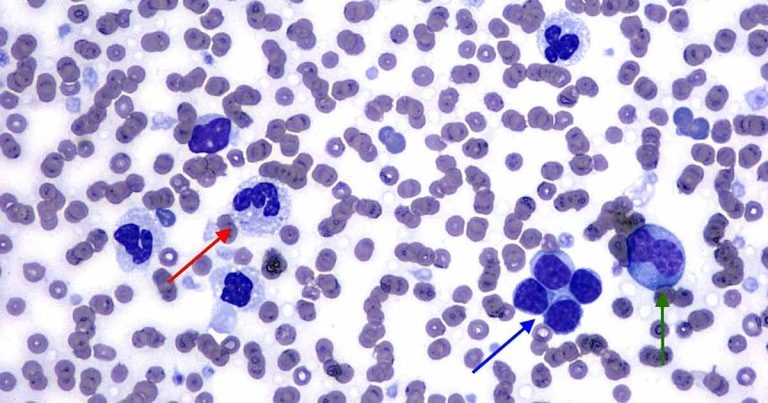 Peripheral leukocytosis case in a dog