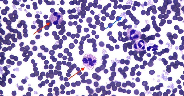 Cat with peripheral leukocytosis