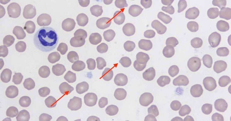 Regenerative anaemia in a cat