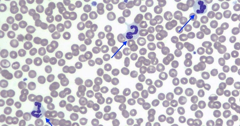 Notable findings from a Norfolk terrier case study