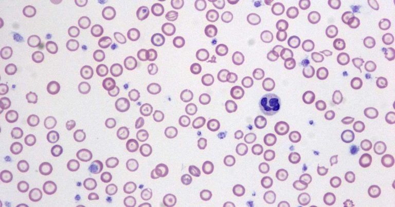 Case of a dog with severe anaemia