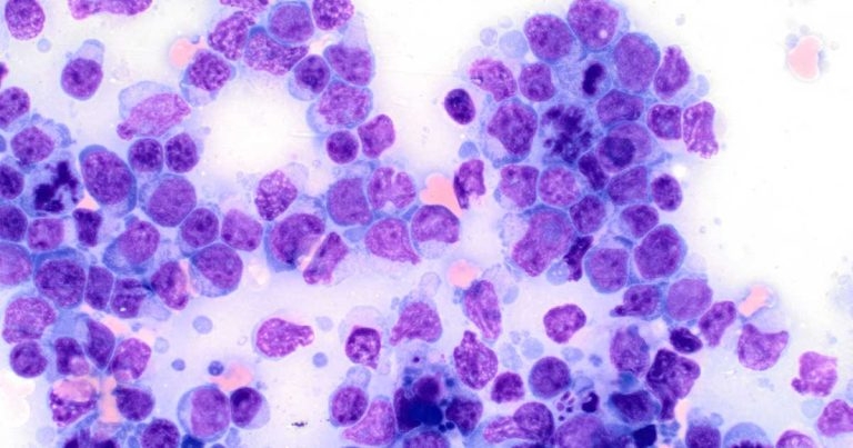 Perspective of canine lymphoma