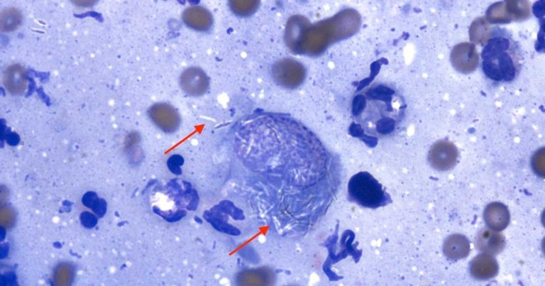 Unexpected findings from a cutaneous mass in a cat