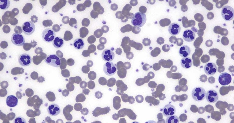 Marked neutrophilia in a dog
