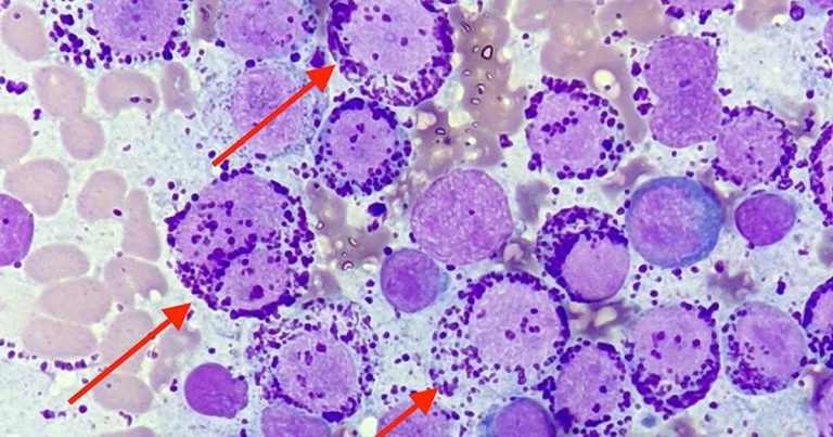 The power of cytology: regional lymphadenomegaly in a dog
