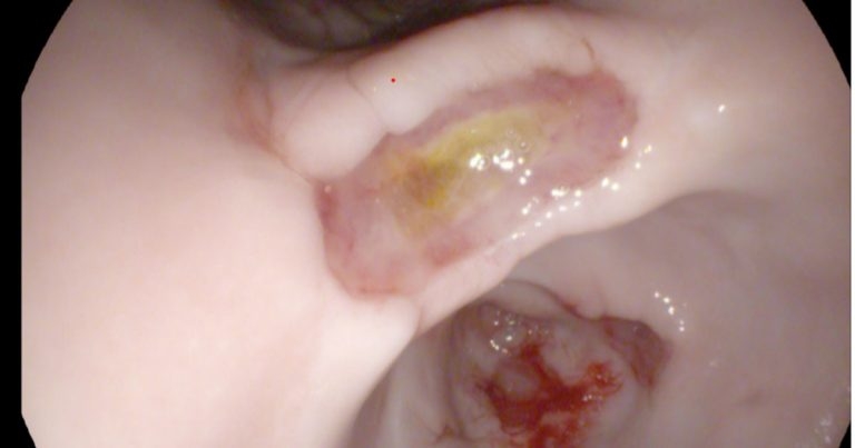 Gastric diseases in dogs: common condition cases