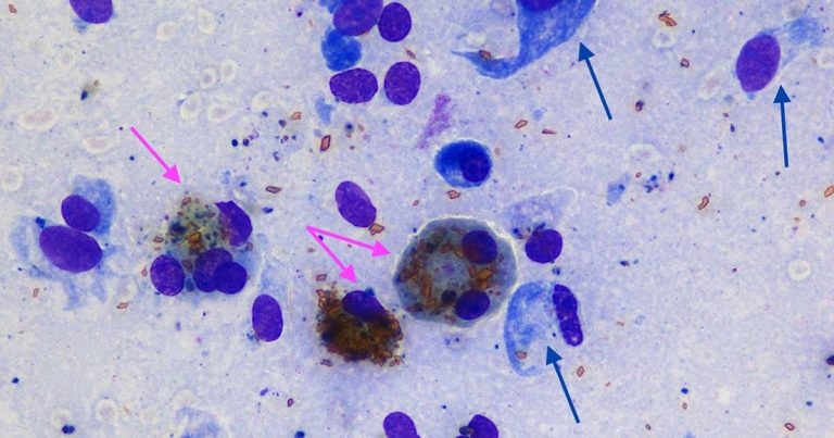 Cytology findings from a stifle swelling in a horse