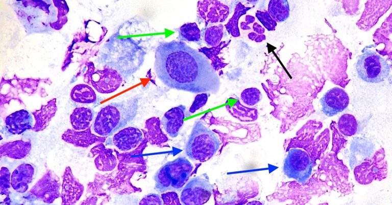 Cytology findings from bilateral corneal lesions in a canine patient