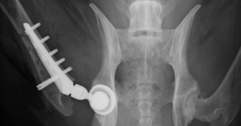 Hip dysplasia: when do we consider surgery?